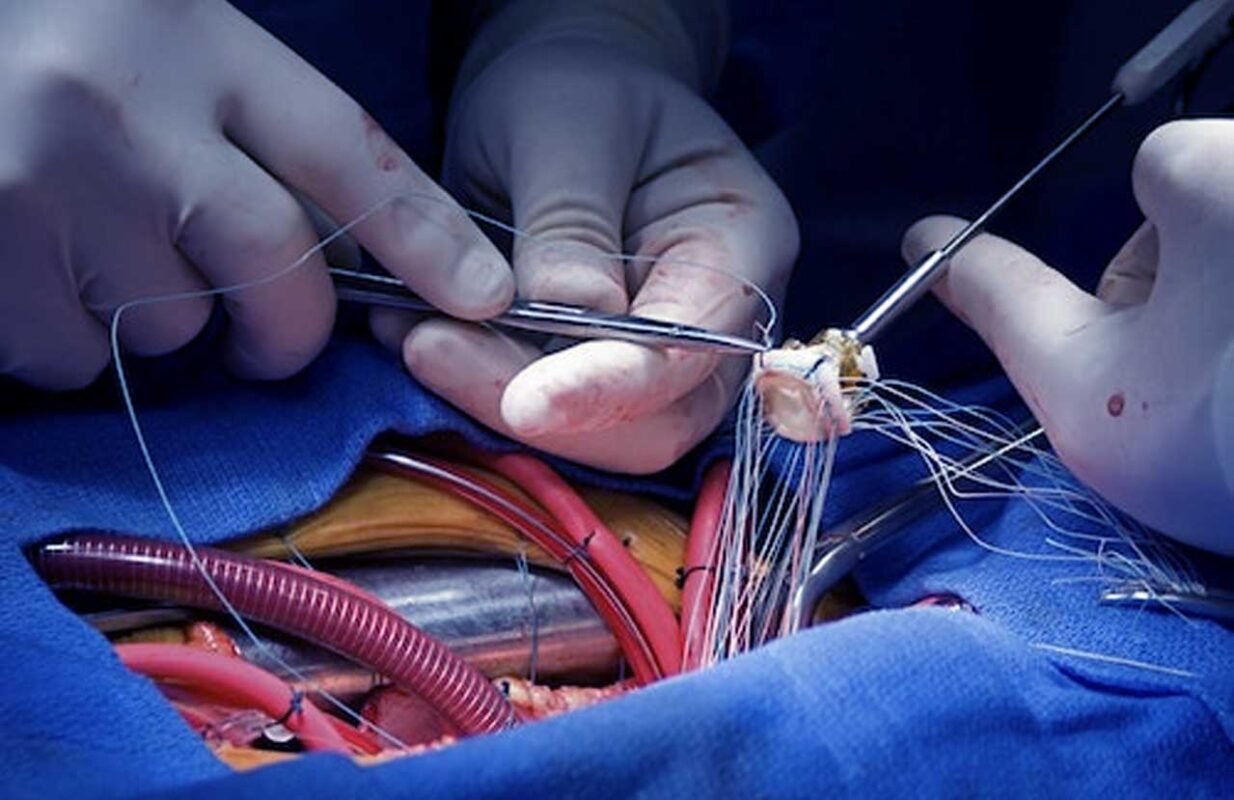 Cardiovascula Neurosurgery Instruments